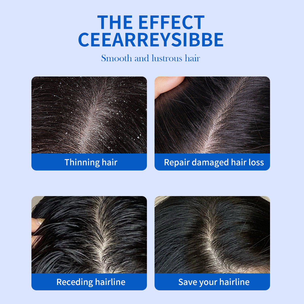 แชมพูขจัดรังแคเซเลนเนียมไดซัลไ - Hair Care Dandruff บทวิจารณ์และราคา
