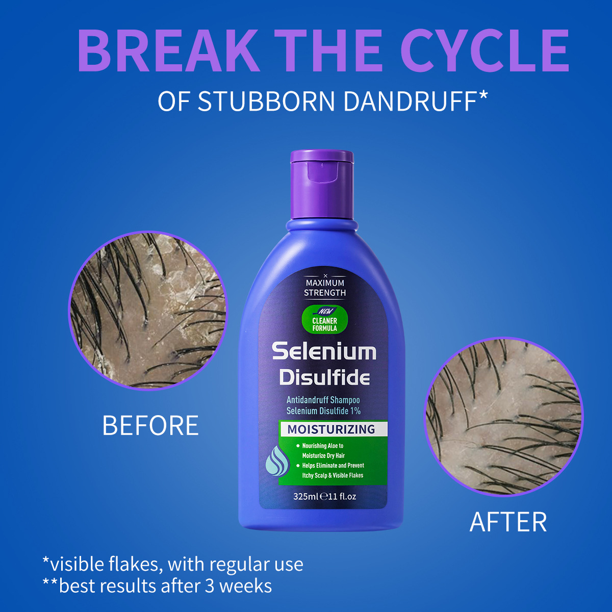 แชมพูขจัดรังแคเซเลนเนียมไดซัลไ - Hair Care Dandruff บทวิจารณ์และราคา